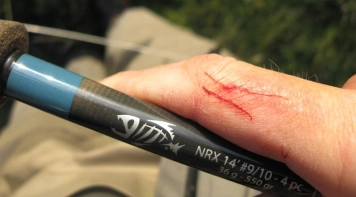 The old war wound The old war wound