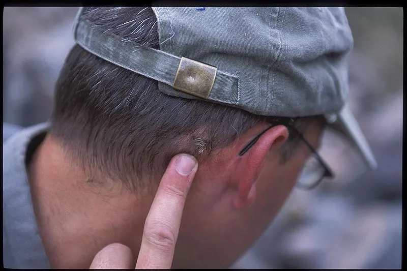 In the neck - "In the hat?", asked Steve. "No! In the head!" answered Martin...